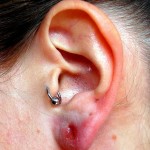 Ear Piercing Infection