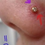 Nose piercing infection