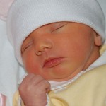 Jaundice in Newborns