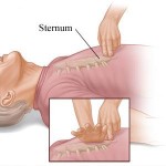Sternum Pain