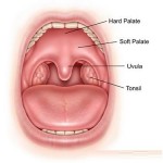 swollen uvula