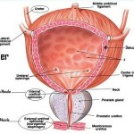 Bladder Infection Symptoms in Women