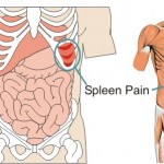 Spleen Pain