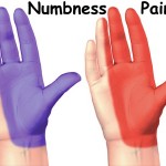 Numbness in Fingers