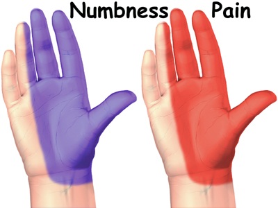 numbness in hands