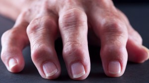Finger Joint Pain