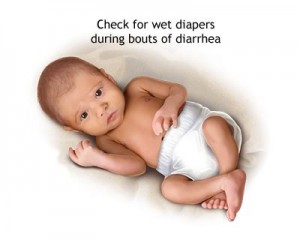 Baby Diarrhea