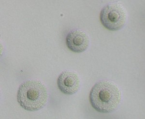 Mycoplasma Hominis