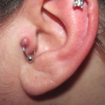 Cartilage Piercing Bump