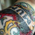 Tattoo Scabbing