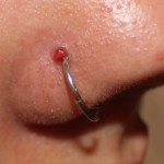 Infected Nose Piercing