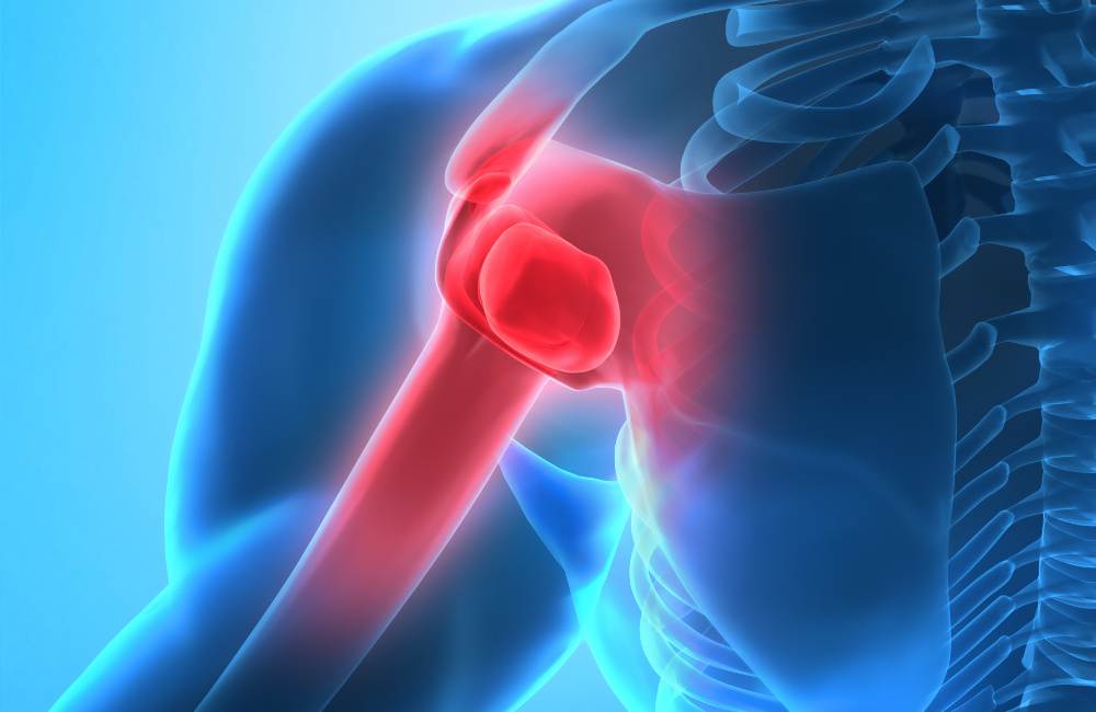 Shoulder Pain Symptoms Causes Diagnosis Treatment Healthmd