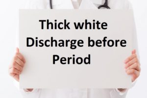White Discharge before period