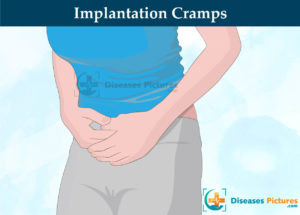 implantation cramps timing