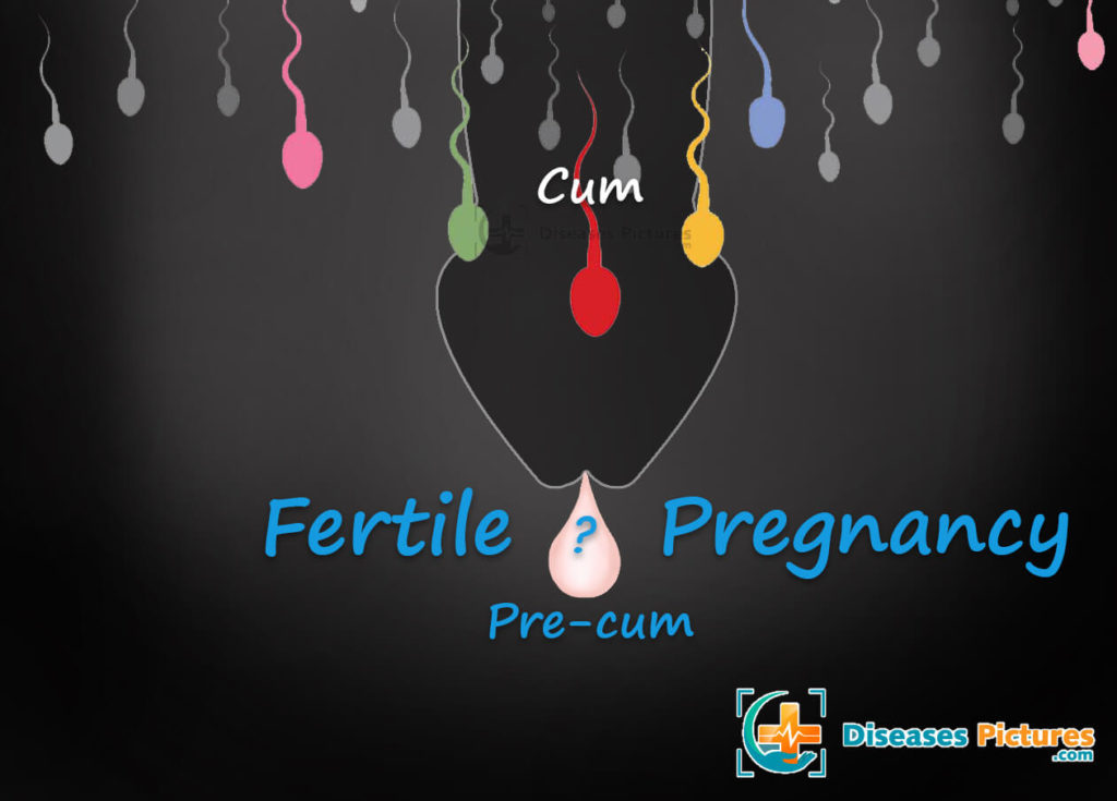 Can You Get Pregnant From Precum Can Precum Get A Girl Pregnant Health Md