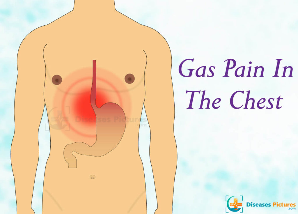 gas pain in chest